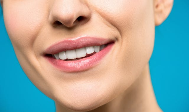 Simak 3 Manfaat Veneer Gigi yang Tidak Banyak Orang Ketahui
